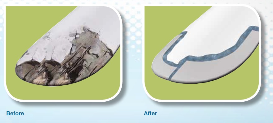 For a blade tip repair, the company suggests Loctite UK 1351 B25 (Structural Bonder) GL-certified, cartridge-dispensed polyurethane with 50 minutes of working life. Polyurethane putty has a work life of 10 minutes and can be sanded in 30 minutes.